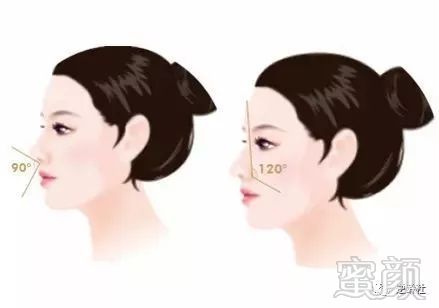 https://img.miyanlife.com/mnt/timg/180307/123335KL-3.jpg