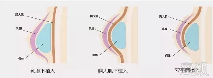 https://img.miyanlife.com/mnt/timg/180307/1236092012-3.jpg