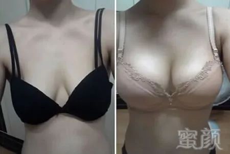 https://img.miyanlife.com/mnt/timg/180307/12361032X-8.jpg