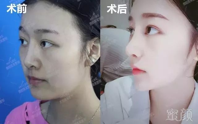 https://img.miyanlife.com/mnt/timg/180308/10195422U-5.jpg