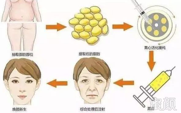 https://img.miyanlife.com/mnt/timg/180308/1034253016-5.jpg