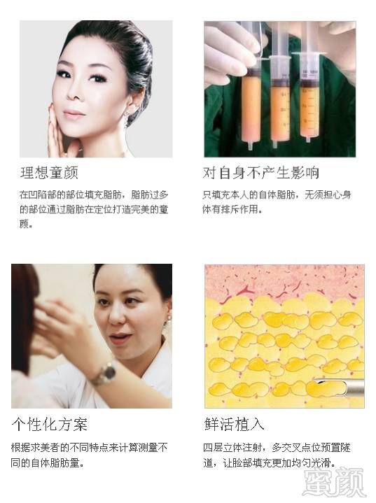 https://img.miyanlife.com/mnt/timg/180308/1034264552-12.jpg