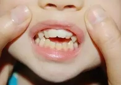 https://img.miyanlife.com/mnt/timg/180308/10432V1U-2.jpg