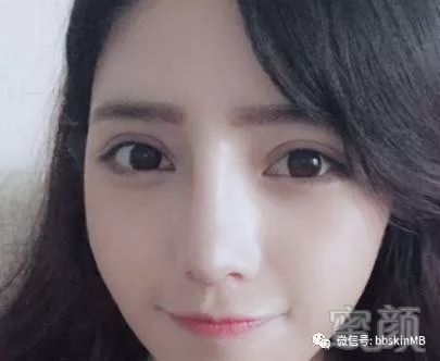 https://img.miyanlife.com/mnt/timg/180308/1140114337-7.jpg