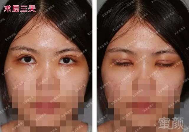 https://img.miyanlife.com/mnt/timg/180308/1223392961-4.jpg