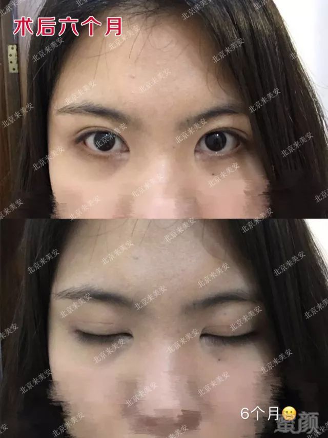 https://img.miyanlife.com/mnt/timg/180308/1223404094-12.jpg