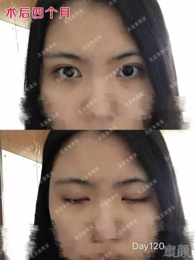 https://img.miyanlife.com/mnt/timg/180308/1223404a9-10.jpg
