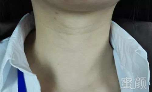 https://img.miyanlife.com/mnt/timg/180308/1234201927-2.jpg