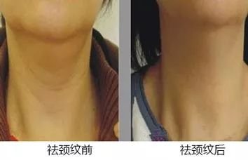 https://img.miyanlife.com/mnt/timg/180308/1234214R0-8.jpg