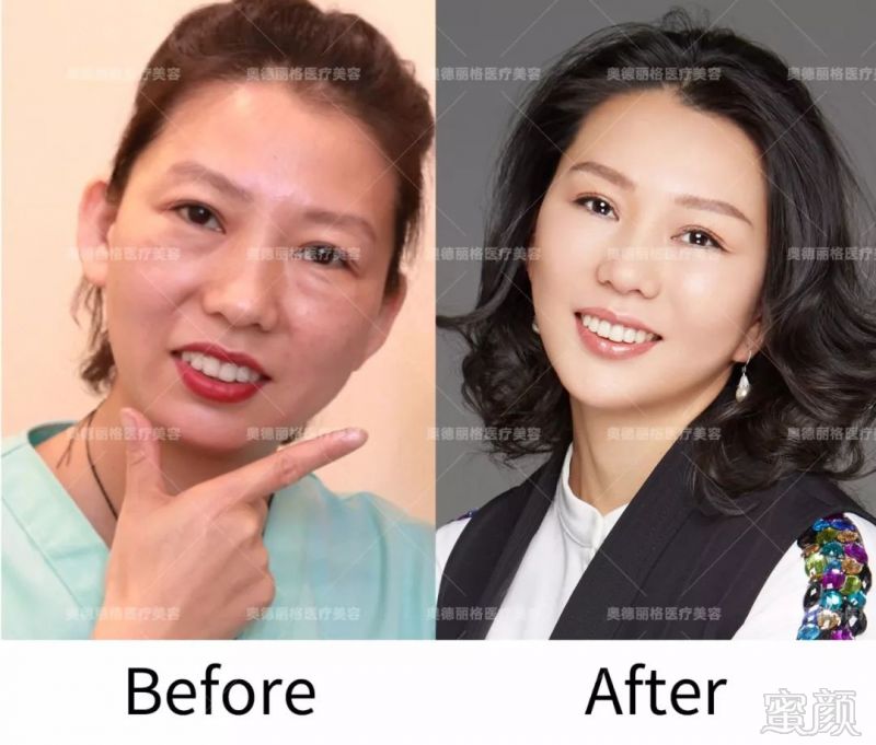 https://img.miyanlife.com/mnt/timg/180308/13201SM8-6.jpg