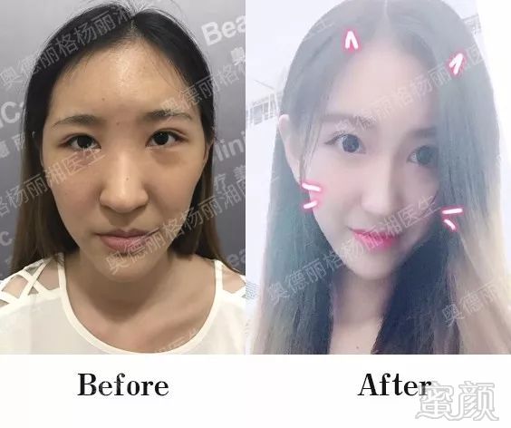 https://img.miyanlife.com/mnt/timg/180308/13201V117-5.jpg