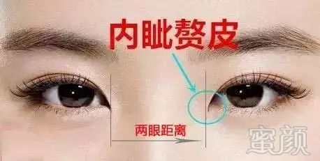 https://img.miyanlife.com/mnt/timg/180308/1325541234-6.jpg