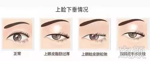 https://img.miyanlife.com/mnt/timg/180308/13255445G-8.jpg