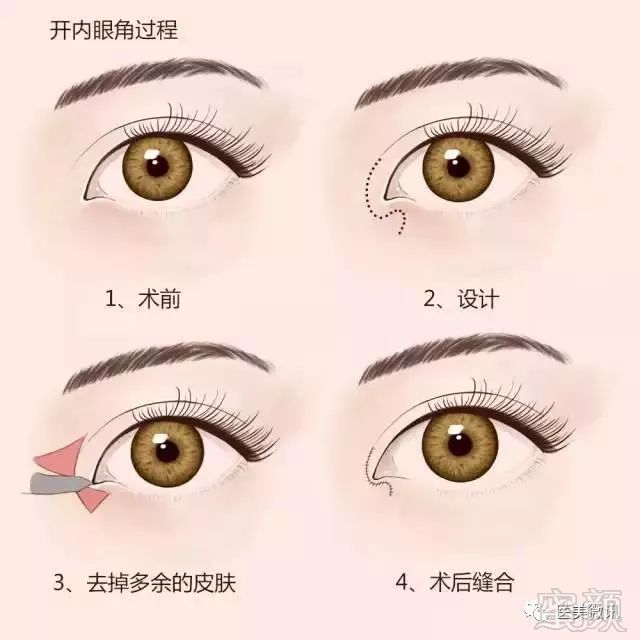 https://img.miyanlife.com/mnt/timg/180308/132RR195-3.jpg