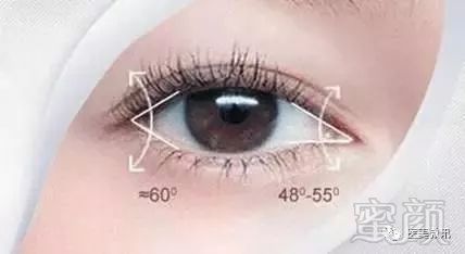 https://img.miyanlife.com/mnt/timg/180308/132RV531-2.jpg