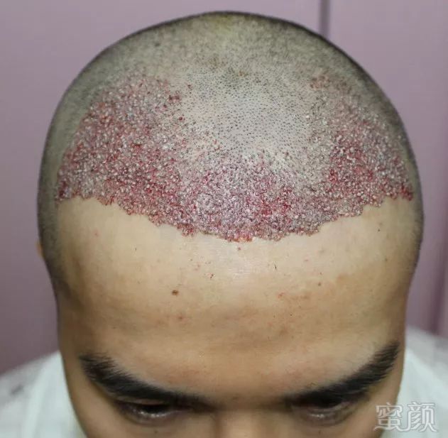 https://img.miyanlife.com/mnt/timg/180308/133ZA135-1.jpg