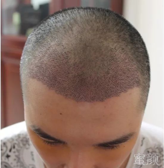 https://img.miyanlife.com/mnt/timg/180308/133ZK301-2.jpg