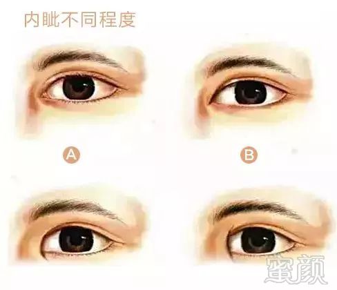 https://img.miyanlife.com/mnt/timg/180309/10393LL3-1.jpg