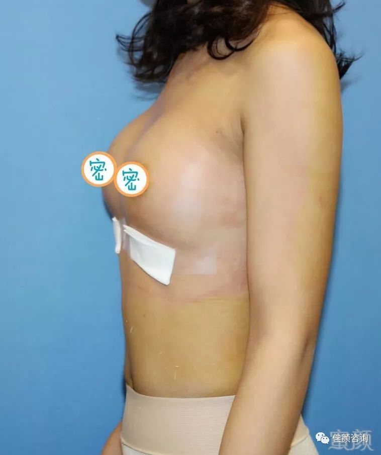 https://img.miyanlife.com/mnt/timg/180309/1049542602-0.jpg