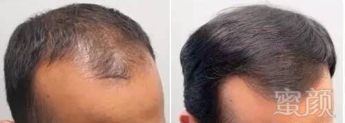 https://img.miyanlife.com/mnt/timg/180309/112J915X-4.jpg