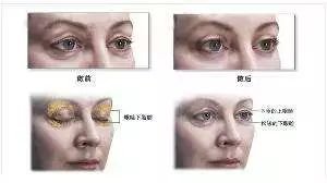 https://img.miyanlife.com/mnt/timg/180309/115020EQ-3.jpg