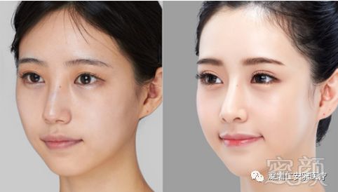 https://img.miyanlife.com/mnt/timg/180309/1239413361-2.jpg