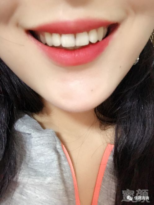 https://img.miyanlife.com/mnt/timg/180309/125K91N0-4.jpg