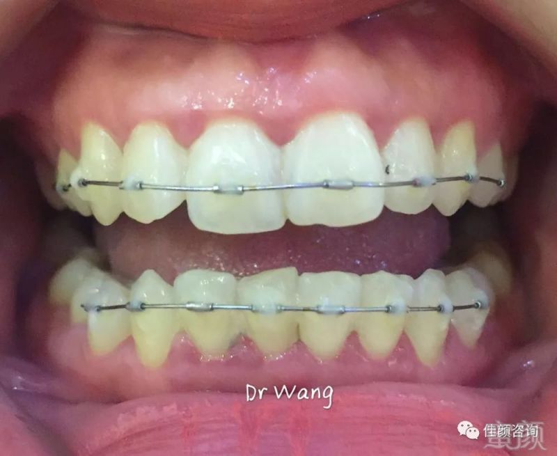 https://img.miyanlife.com/mnt/timg/180309/125KR1a-1.jpg