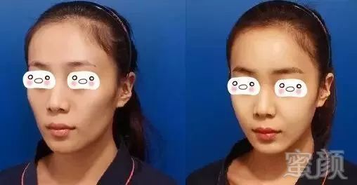 https://img.miyanlife.com/mnt/timg/180310/1006054317-4.jpg