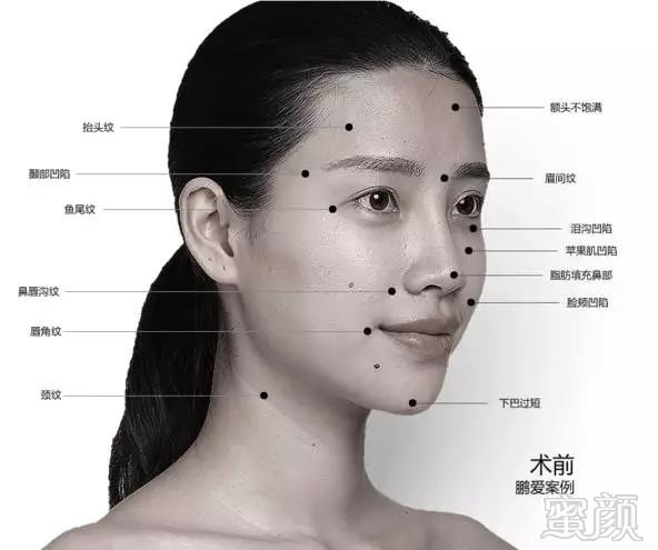 https://img.miyanlife.com/mnt/timg/180310/100605N18-2.jpg