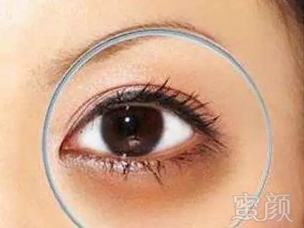 https://img.miyanlife.com/mnt/timg/180310/1055395140-7.jpg