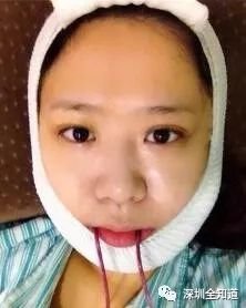 https://img.miyanlife.com/mnt/timg/180310/1101463L0-2.jpg