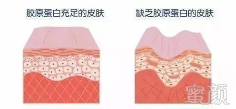 https://img.miyanlife.com/mnt/timg/180310/1105051K9-6.jpg