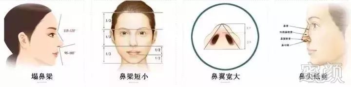 https://img.miyanlife.com/mnt/timg/180310/1106304031-4.jpg