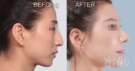 https://img.miyanlife.com/mnt/timg/180310/11063155U-10.jpg