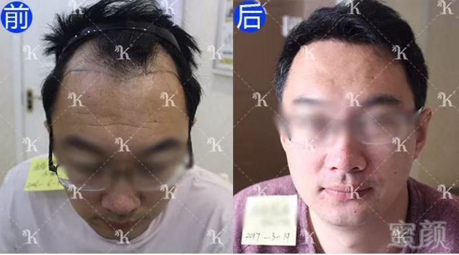 https://img.miyanlife.com/mnt/timg/180310/11094GZ5-4.jpg