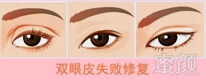 https://img.miyanlife.com/mnt/timg/180310/1112325438-5.jpg