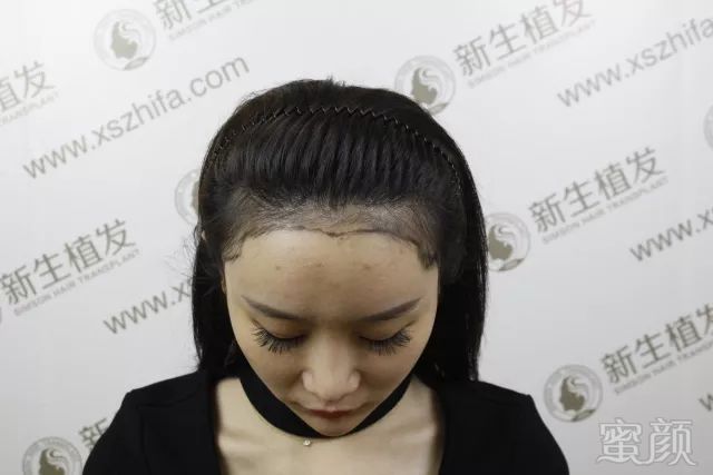 https://img.miyanlife.com/mnt/timg/180310/1113204030-3.jpg