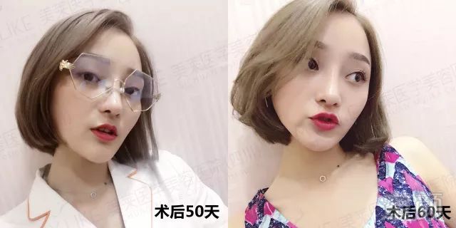 https://img.miyanlife.com/mnt/timg/180311/1044331313-14.jpg