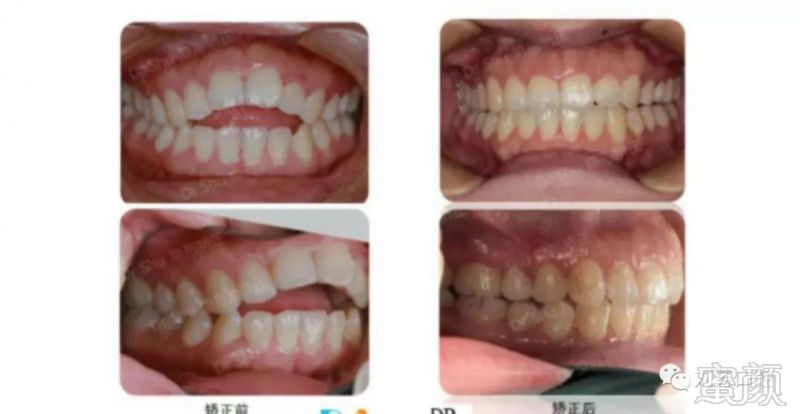 https://img.miyanlife.com/mnt/timg/180311/1104153500-5.jpg