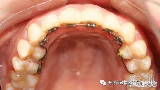https://img.miyanlife.com/mnt/timg/180311/1129211U5-4.jpg
