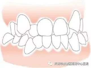 https://img.miyanlife.com/mnt/timg/180311/1129214G9-0.jpg