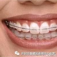 https://img.miyanlife.com/mnt/timg/180311/1129215308-2.jpg