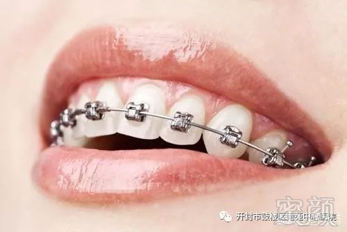https://img.miyanlife.com/mnt/timg/180311/112921KU-1.jpg