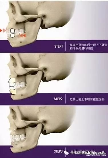 https://img.miyanlife.com/mnt/timg/180311/112922A26-5.jpg