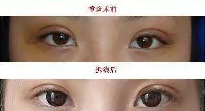 https://img.miyanlife.com/mnt/timg/180311/1133241Q9-8.jpg