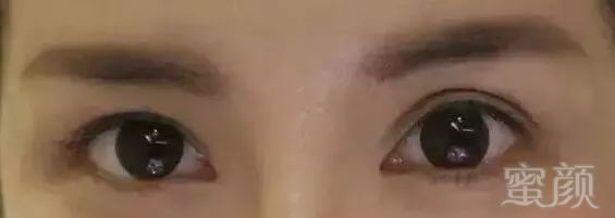 https://img.miyanlife.com/mnt/timg/180311/11332452J-6.jpg