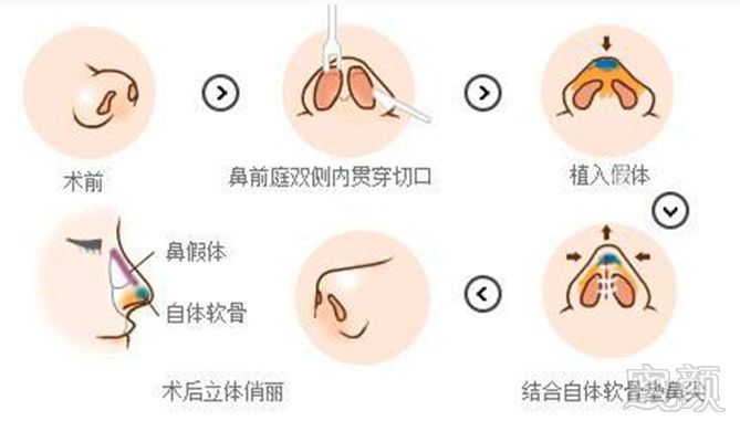 https://img.miyanlife.com/mnt/timg/180311/1143225500-7.jpg