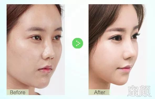 https://img.miyanlife.com/mnt/timg/180311/1143243P4-11.jpg