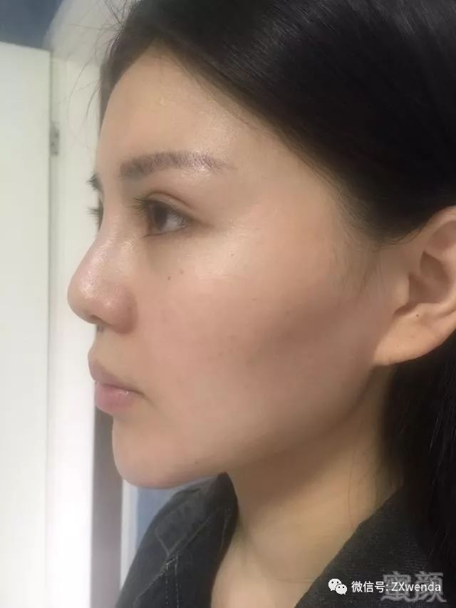 https://img.miyanlife.com/mnt/timg/180311/1154343450-3.jpg